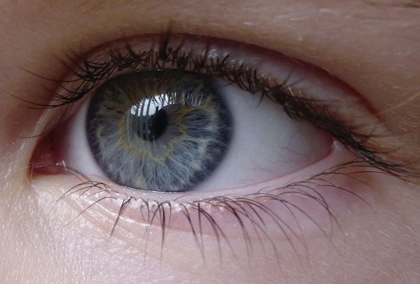 Che cos’è la sindrome dell' ’'occhio secco”?