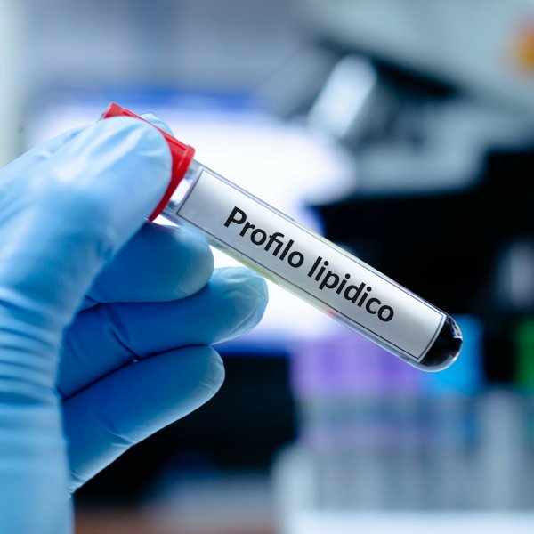 Profilo lipidico